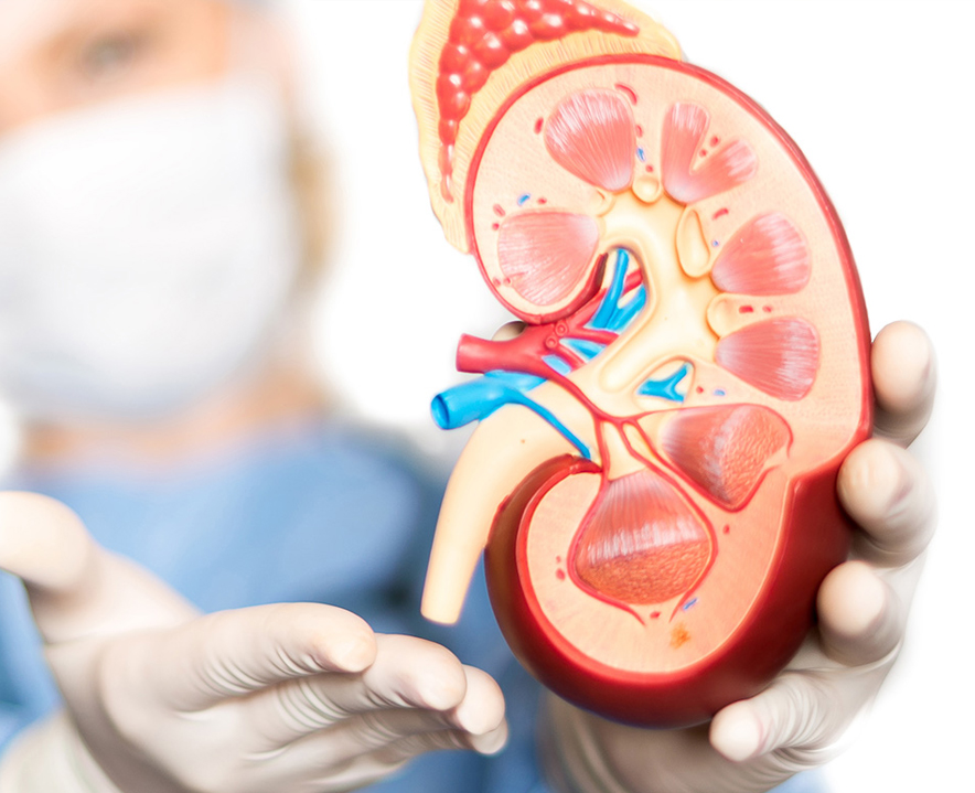 A complete Guide to Kidney Transplants
