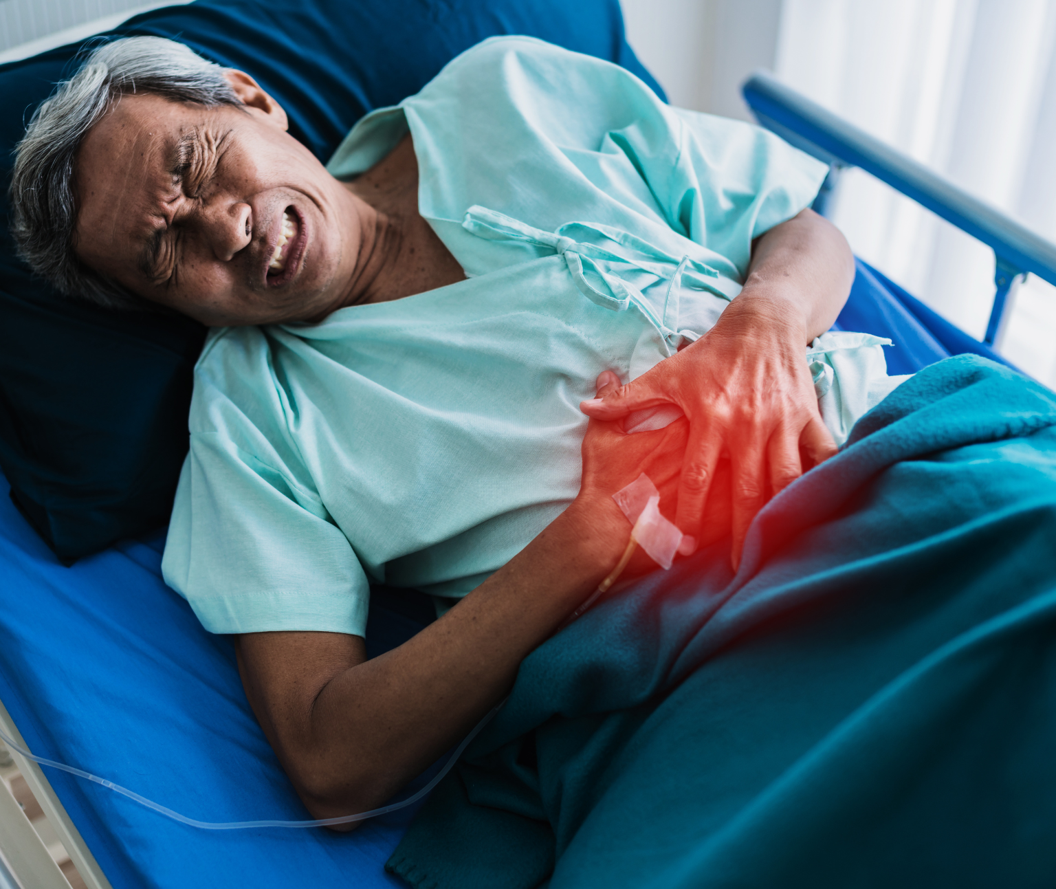 DJ Stenting for Kidney Stones in Bangalore