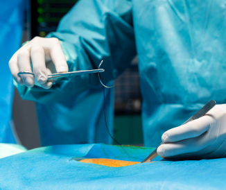 How Much Does Prostate Surgery Really Cost in Bangalore?